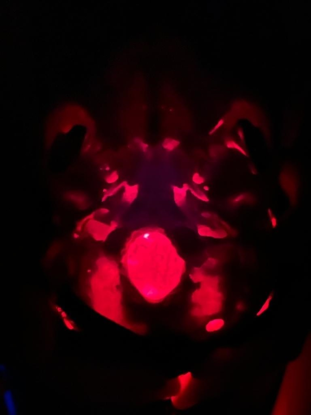 La terapia luminosa transcranica e Taopatch® 