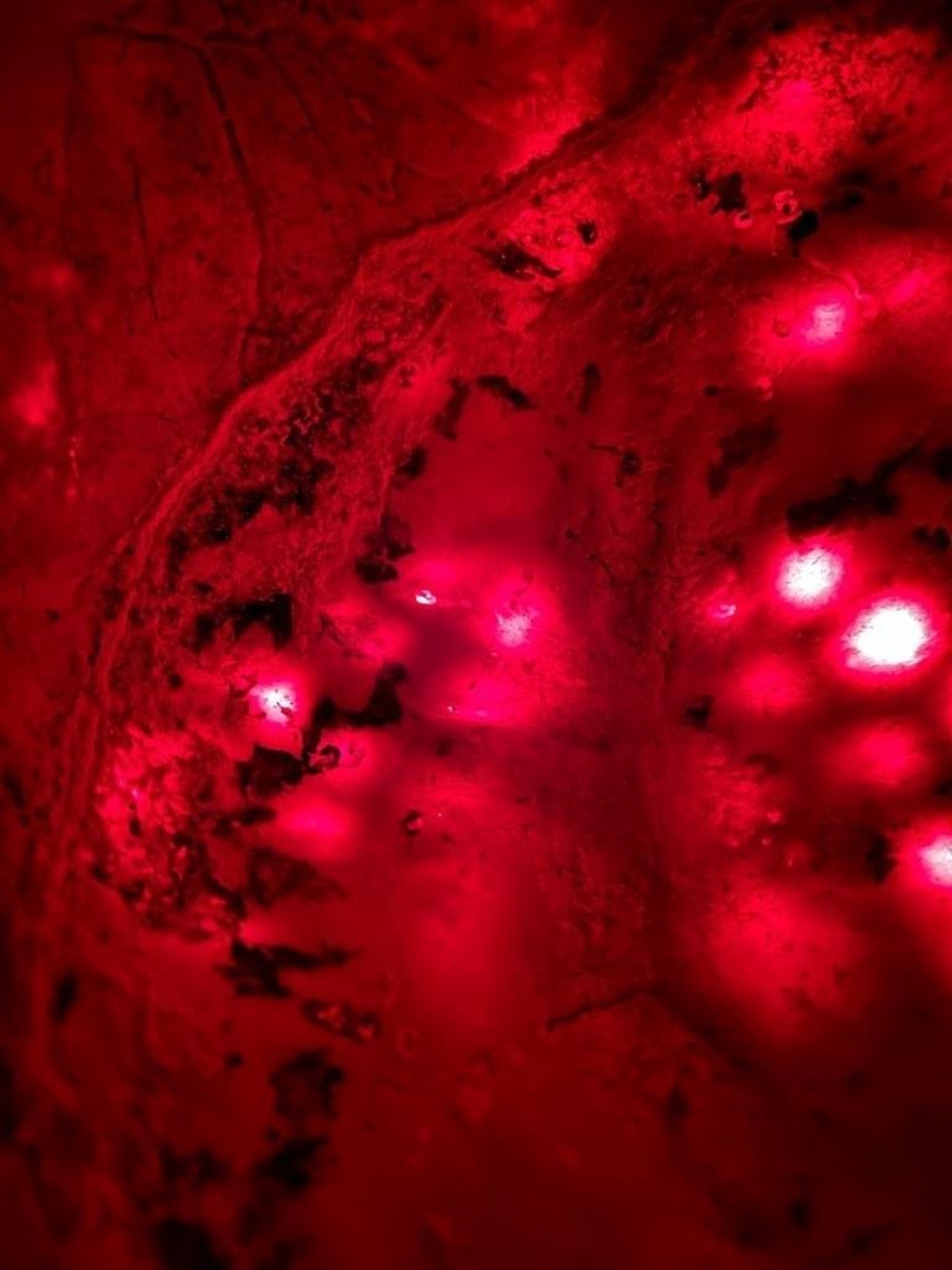 La terapia luminosa transcranica e Taopatch®