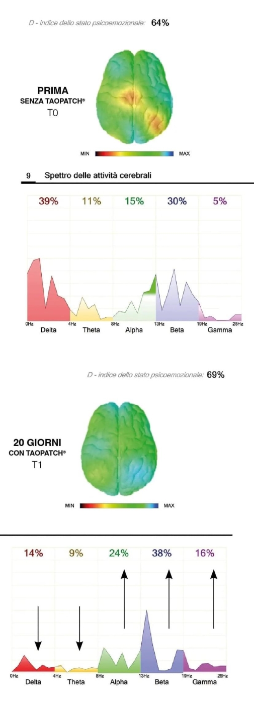 Misurazione del Cervello - Taopatch®